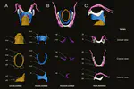 Comparative anatomy of the vocal apparatus in bats and implications for the diversity of laryngeal echolocation