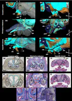The development of orofacial complex in bats: Implications for orofacial clefting 