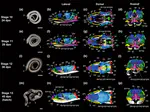 Embryonic development and cranial ossification of the Japanese Aodaishō, Elaphe climacophora (Serpentes: Colubridae): with special reference to the prootic bone and auditory evolution in snakes